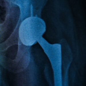 tek asamali ameliyatla sagligina kavustu 7tEZs5We